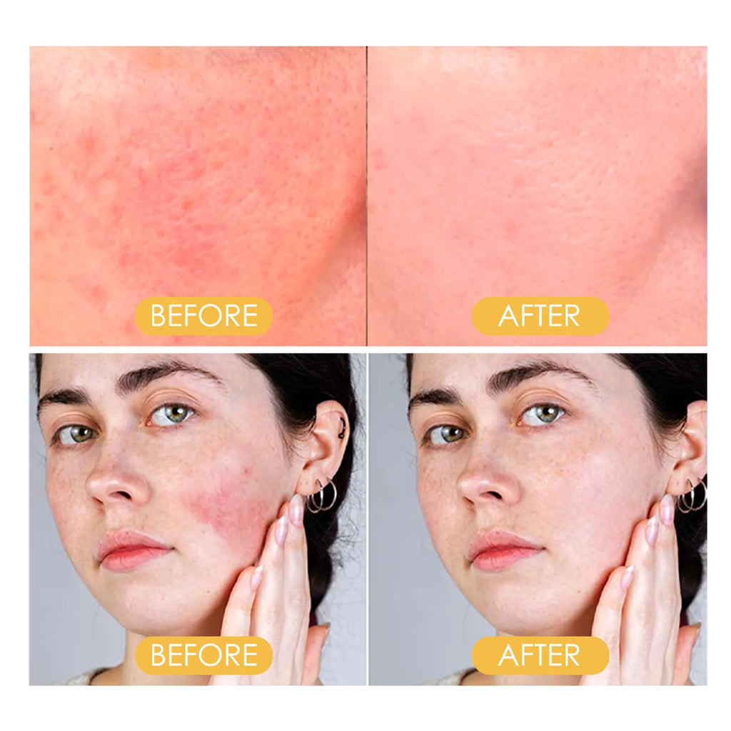 protetor solar FPS 50 à prova d'água